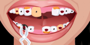 Hra - Crazy Dentist